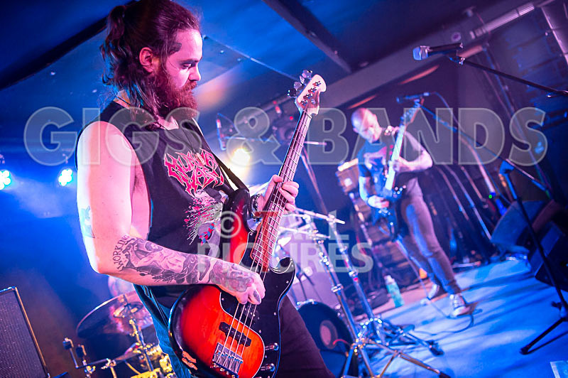 Of Abscess and Amputation-29 - OF ABSCESS AND AMPUTATION