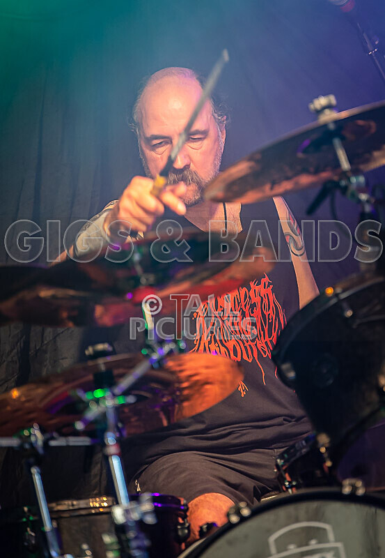 Of Abscess and Amputation-49 - OF ABSCESS AND AMPUTATION