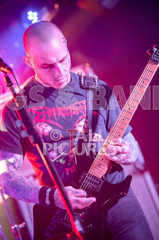 Of Abscess and Amputation-15 - OF ABSCESS AND AMPUTATION