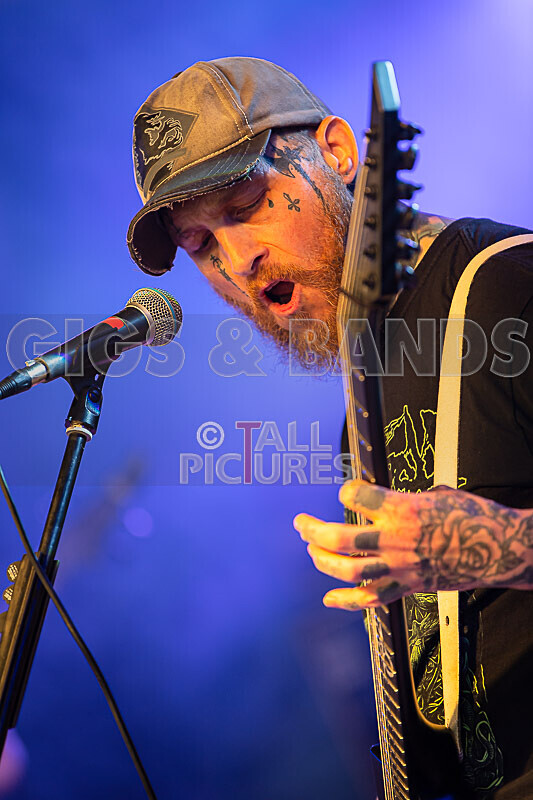 Of Abscess and Amputation-30 - OF ABSCESS AND AMPUTATION