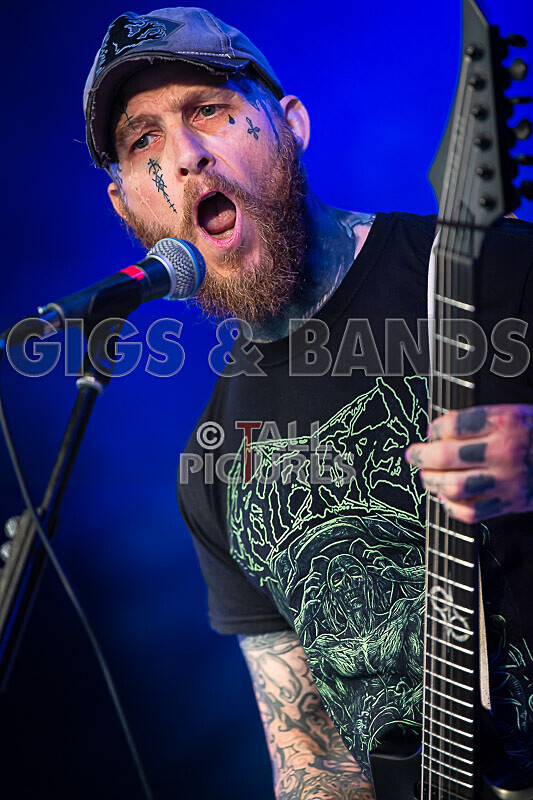 Of Abscess and Amputation-42 - OF ABSCESS AND AMPUTATION