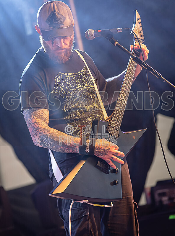 Of Abscess and Amputation-53 - OF ABSCESS AND AMPUTATION