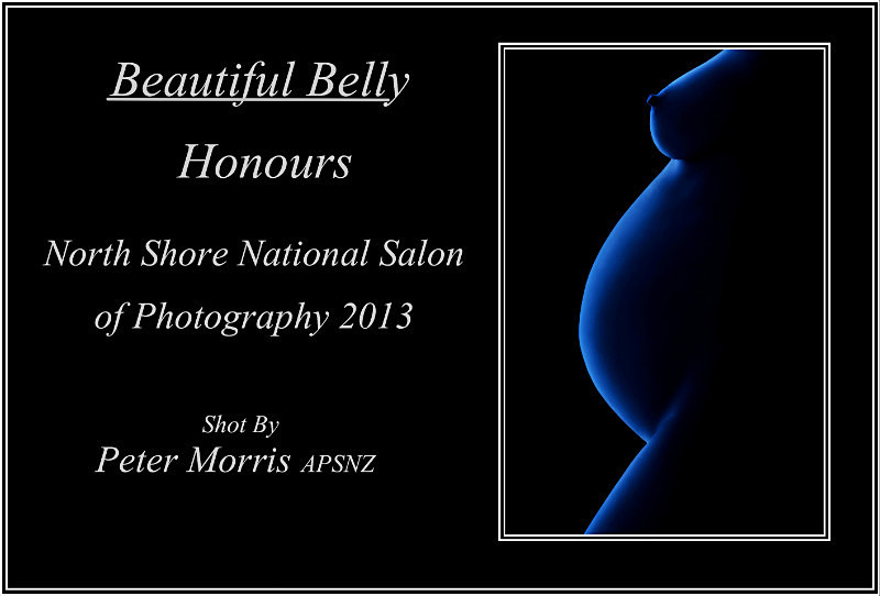  - Awards