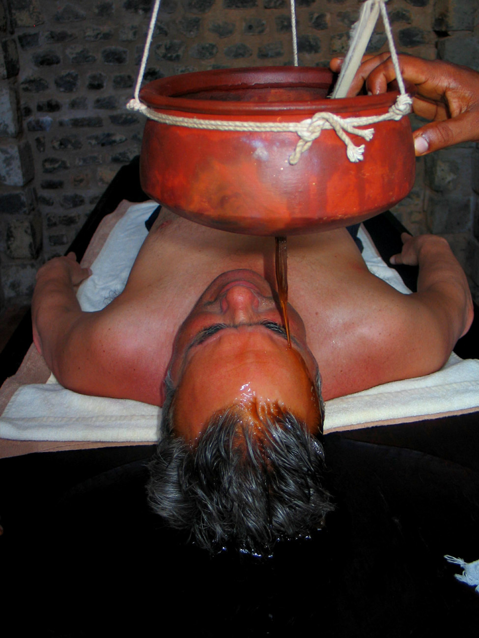 AAyurvedic oil treatment at Suya Samudra Spa - Kerala - India